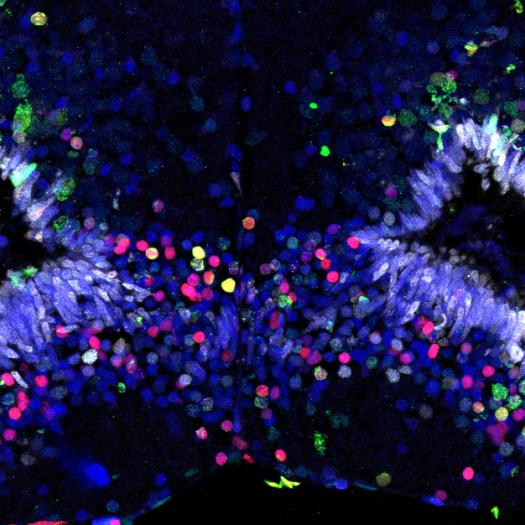 Populations of both slow- and fast-cycling progenitors in Xenopus tadpole brain  © MNHN-Laetitia Préau, Guyslaine Morvan-Dubois, Barbara Demeneix 